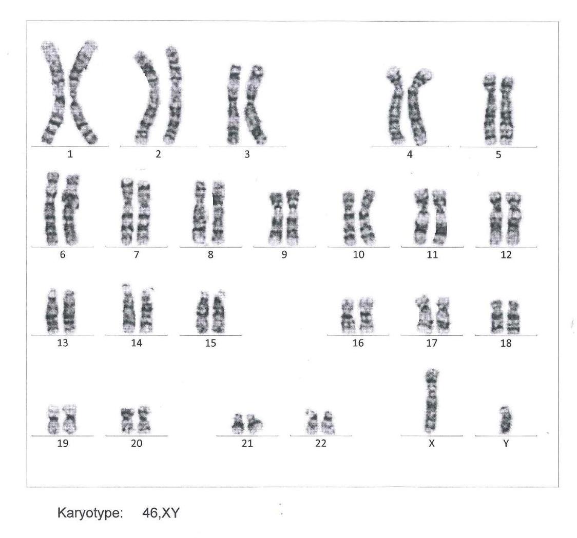 Chromosomal Scan Report_blog